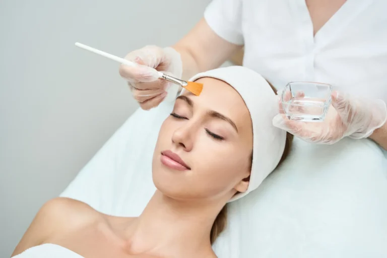 Unleash Clear and Confident Skin with Chemical Peeling Treatment