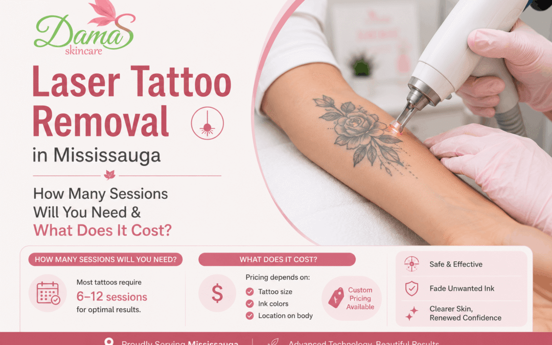 Laser Tattoo Removal in Mississauga: How Many Sessions Will You Need & What Does It Cost?
