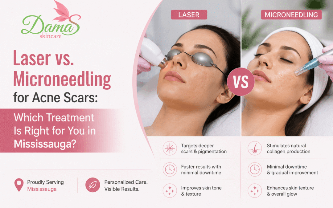 Laser vs. Microneedling for Acne Scars: Which Treatment Is Right for You in Mississauga?