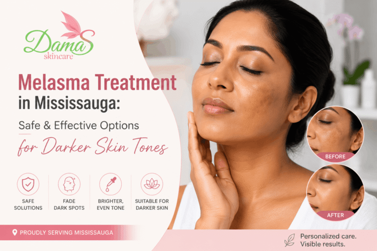 Woman receiving professional melasma treatment in Mississauga for safe hyperpigmentation removal on darker skin tones